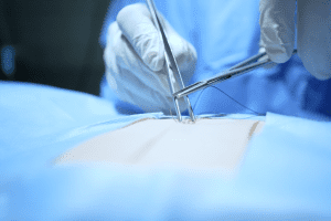 Entrenamiento en técnicas de sutura