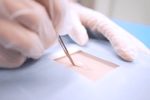 Bases teóricas y simulación en cirugía menor