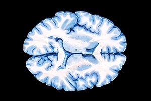 Diplomado en Neuroanatomía humana con aplicación clínica
